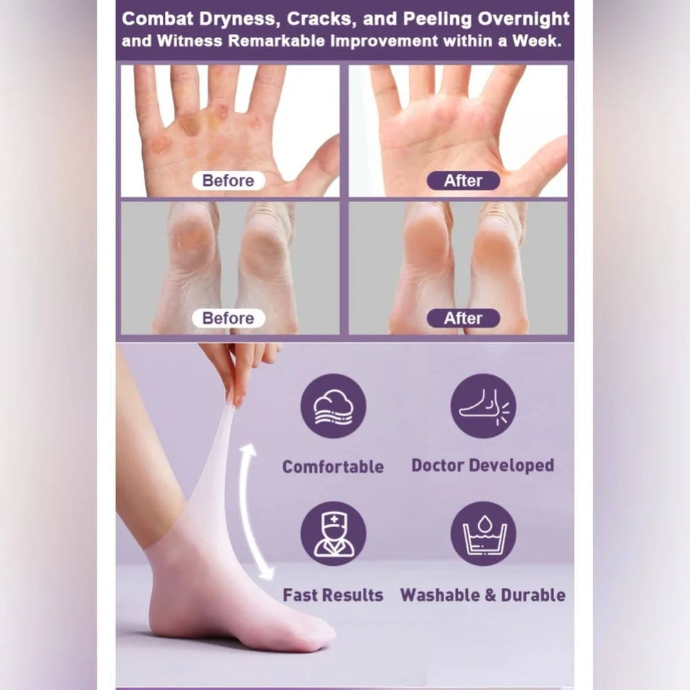 Unisex Silicone Socks & Gloves for Dry Cracked Skin (Socks Fits Up to Size 8.5)